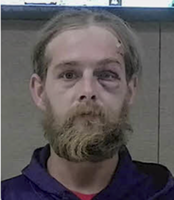 While male with blonde hair and medium sized beard. Man has a black eye and is wearing a purple hoodie