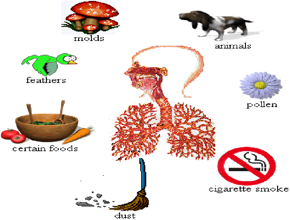 Diagram illustrating common asthma triggers including molds, animals, pollen, feathers, certain foods, cigarette smoke, and dust surrounding inflamed human lungs