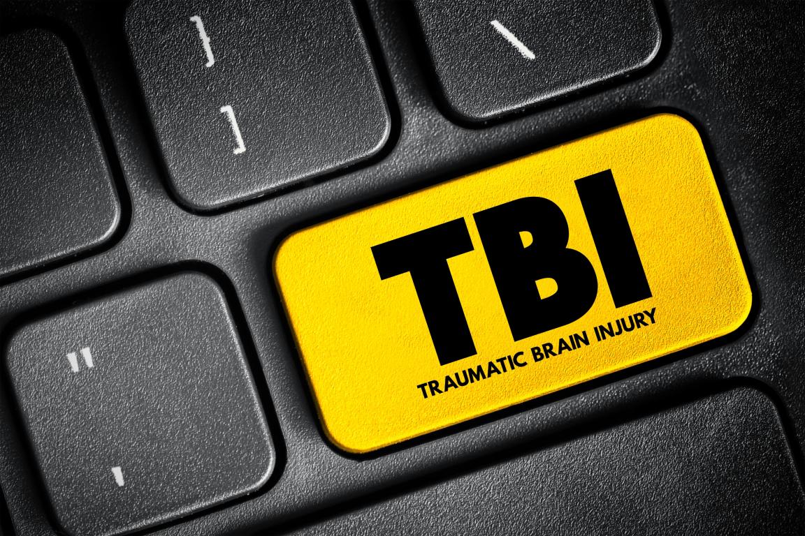 Traumatic Brain Injury waiver 