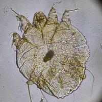 closeup view of scarcoptes scabiei mite