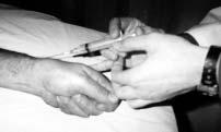 Injection site for de Quervain