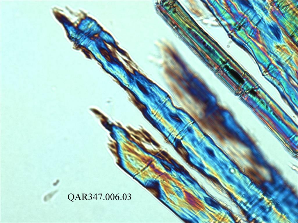 Bast Fibers with Advanced Bio-deterioration under a Polarized Light Microscope